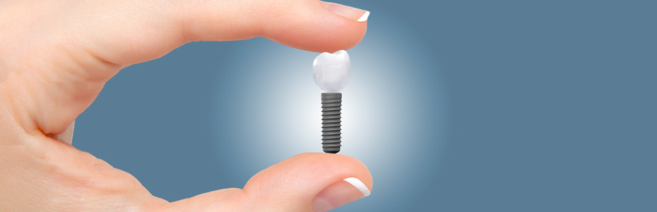 Sanfte Implantologie